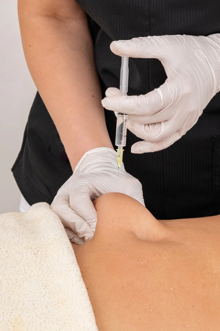 Lipo Dissolve injection procedure on patient’s body by medical professional