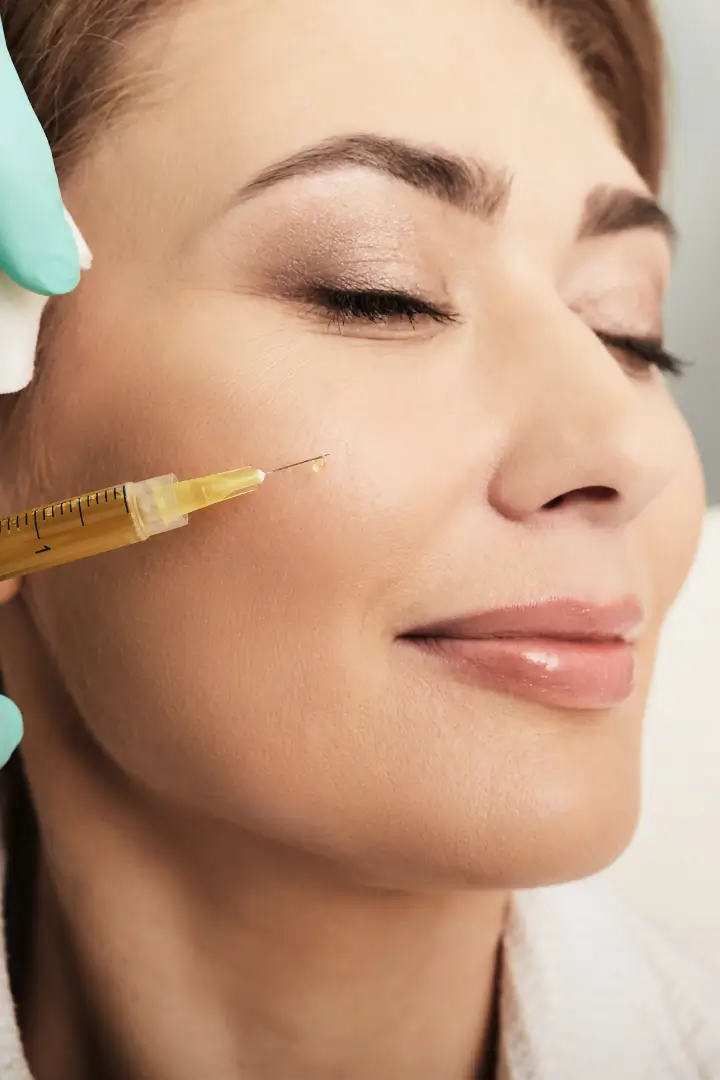 Close-up of a woman receiving PRF Bio Gel injection for facial rejuvenation treatment